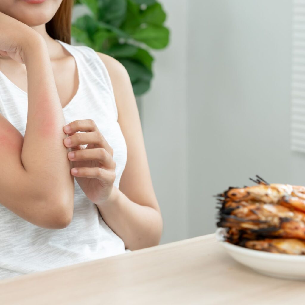 Food Sensitivity